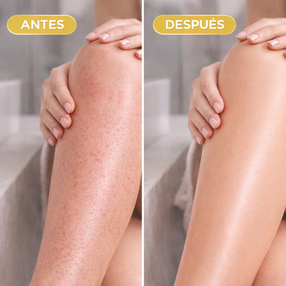 Lumivé | Kit Depilación Femenina Sin Dolor