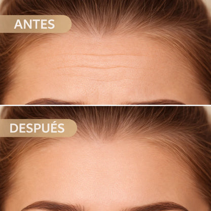 Luméa | Kit Parches Tensores Antiarrugas